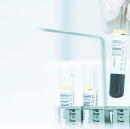 液相色谱化工应用